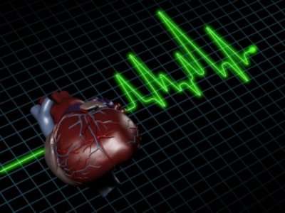 infarto_540 28 рекомендаций народной медицины при лечении инфаркта миокарда