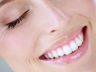otbelivanie-zubov Пломбирование зубов и установка виниров