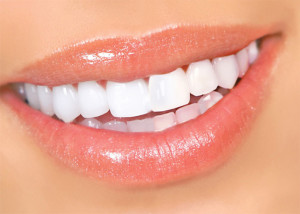86438660_2247000_Dent_b-300x214 7 методов отбеливания зубов