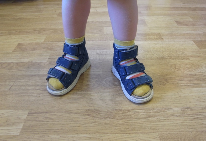 Q2a6mM9L5JA Как правильно подобрать ортопедическую обувь для ребенка: 10 советов